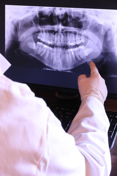 Best Emergency Treatment for Oral Infections in Kelseyville, CA