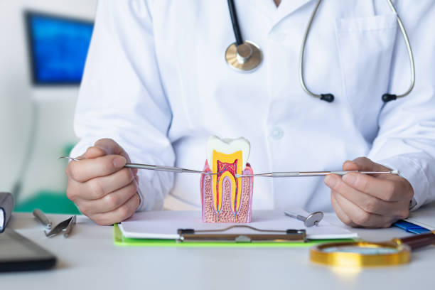 Best Knocked-Out Tooth (Avulsed Tooth) Treatment in Kelseyville, CA